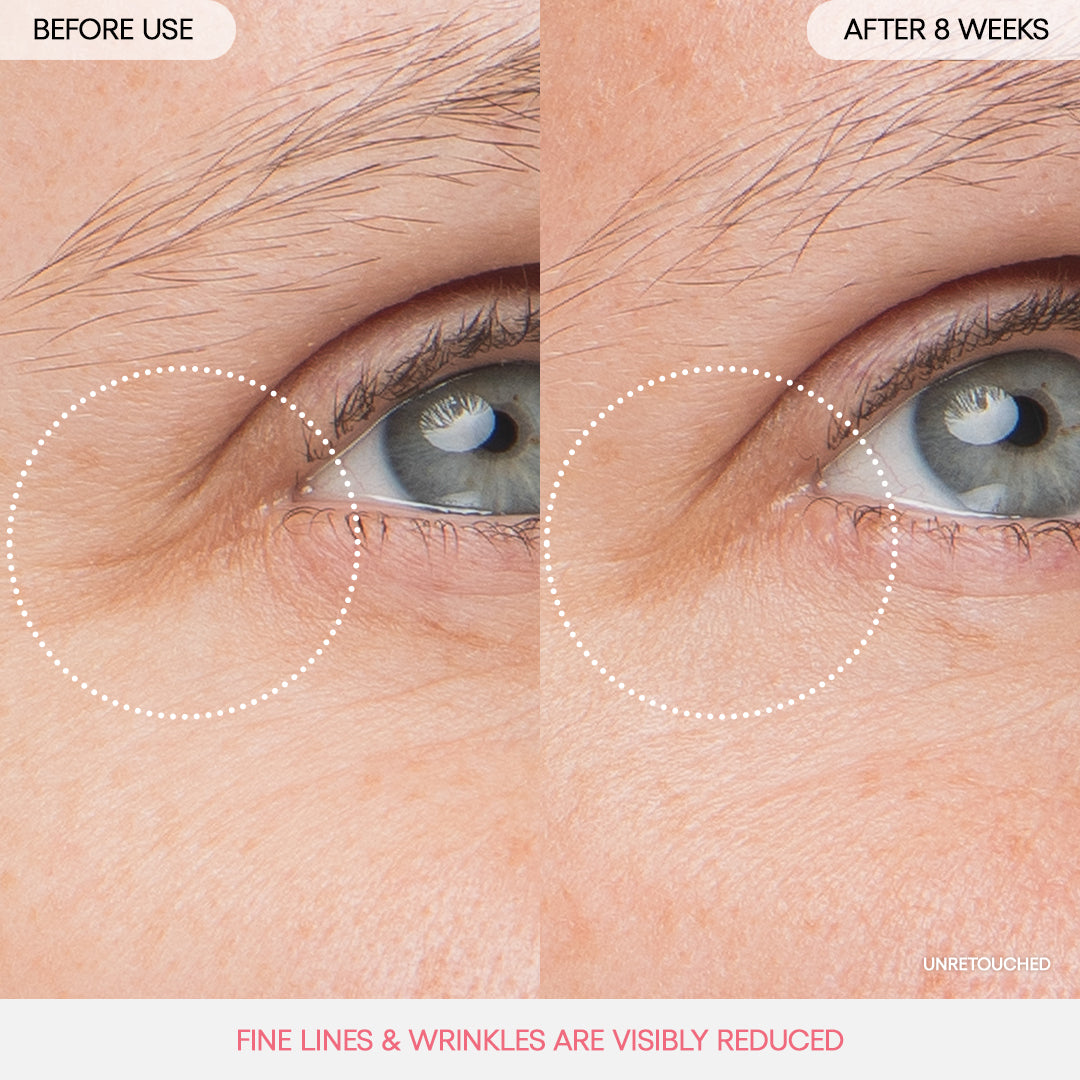 Bouncy & Firm Eye Sleeping Mask - Image 2