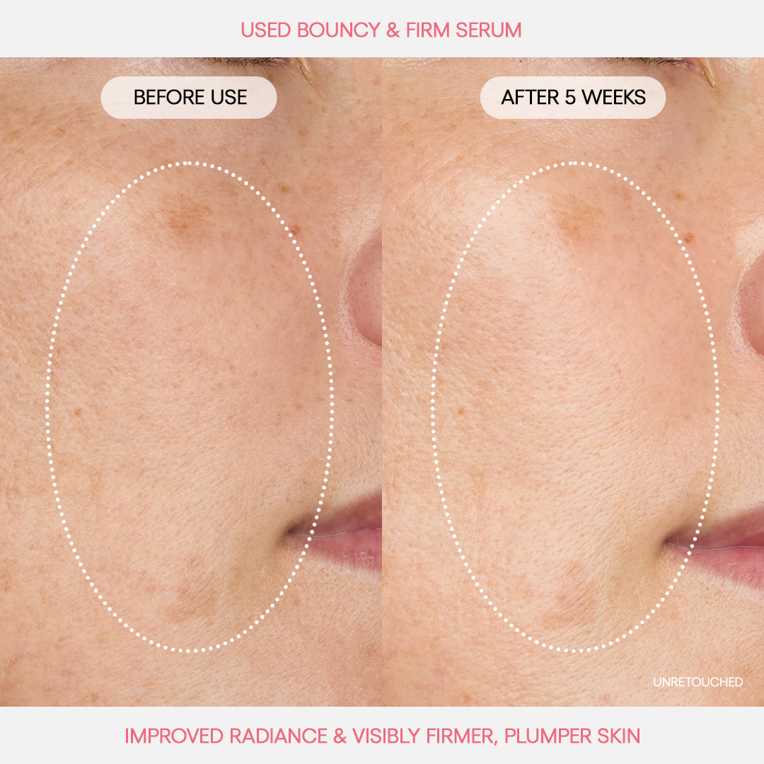Bouncy & Firm Serum - Image 3